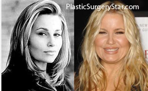 jennifer coolidge before surgery|Plastic Surgery • Dermatology 